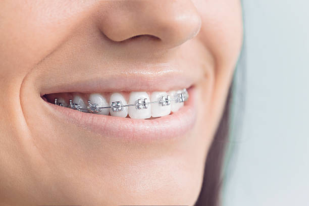 Best Teeth Whitening  in Panama City, FL